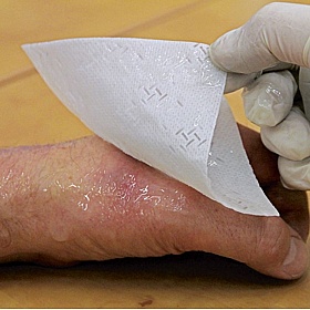 Workplace First Aid Burn Relief Dressing - Office Accessories